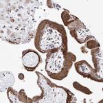 LACE1 Antibody in Immunohistochemistry (Paraffin) (IHC (P))