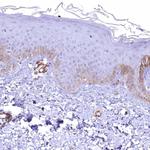 SYNPO2 Antibody in Immunohistochemistry (IHC)
