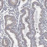 SLCO4A1 Antibody in Immunohistochemistry (Paraffin) (IHC (P))