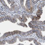 SLCO4A1 Antibody in Immunohistochemistry (Paraffin) (IHC (P))