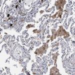 SLCO4A1 Polyclonal Antibody