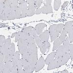 SLCO4A1 Antibody in Immunohistochemistry (Paraffin) (IHC (P))