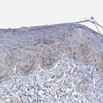 SLCO4A1 Polyclonal Antibody