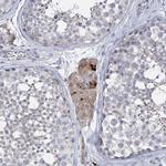 SLCO4A1 Antibody in Immunohistochemistry (Paraffin) (IHC (P))
