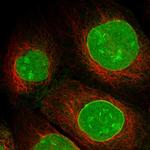 SAMD15 Polyclonal Antibody