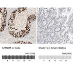 SAMD15 Antibody in Immunohistochemistry (IHC)