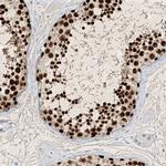 SAMD15 Antibody in Immunohistochemistry (IHC)