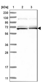 SAMD15 Antibody in Western Blot (WB)