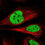 SAMD15 Antibody in Immunocytochemistry (ICC/IF)