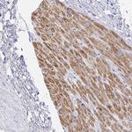 SH3BGR Polyclonal Antibody