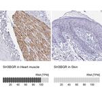 SH3BGR Antibody in Immunohistochemistry (IHC)