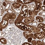 OSGEPL1 Antibody in Immunohistochemistry (Paraffin) (IHC (P))