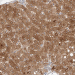OSGEPL1 Antibody in Immunohistochemistry (Paraffin) (IHC (P))