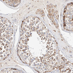 OSGEPL1 Antibody in Immunohistochemistry (Paraffin) (IHC (P))