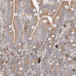 OSGEPL1 Antibody in Immunohistochemistry (Paraffin) (IHC (P))