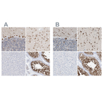 RCN2 Antibody in Immunohistochemistry (Paraffin) (IHC (P))