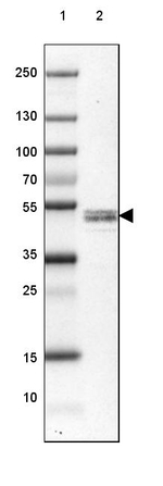 RCN2 Antibody in Western Blot (WB)