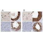 RCN2 Antibody in Immunohistochemistry (IHC)