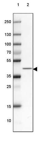 RCN2 Antibody in Western Blot (WB)