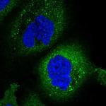 ZGRF1 Polyclonal Antibody