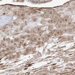 ZGRF1 Antibody in Immunohistochemistry (IHC)