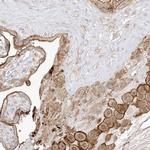 ZGRF1 Polyclonal Antibody