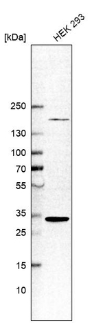 ARD1A Antibody in Western Blot (WB)