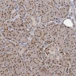 PMM1 Polyclonal Antibody