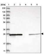 PMM1 Antibody in Western Blot (WB)