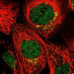 MDFIC Polyclonal Antibody