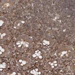 MDFIC Antibody in Immunohistochemistry (IHC)