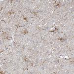 ARHGEF40 Polyclonal Antibody