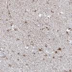 ARHGEF40 Polyclonal Antibody