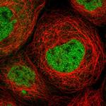 MKL1 Polyclonal Antibody