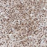 NT5C3B Antibody in Immunohistochemistry (Paraffin) (IHC (P))