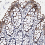 HEATR6 Antibody in Immunohistochemistry (Paraffin) (IHC (P))