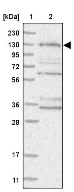 HEATR6 Antibody in Western Blot (WB)