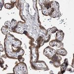 HEATR6 Antibody in Immunohistochemistry (IHC)