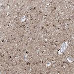 ANGEL2 Antibody in Immunohistochemistry (Paraffin) (IHC (P))