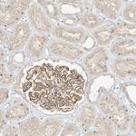 ANGEL2 Antibody in Immunohistochemistry (Paraffin) (IHC (P))