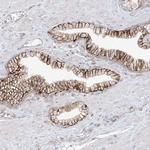 ANGEL2 Antibody in Immunohistochemistry (Paraffin) (IHC (P))