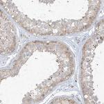 ANGEL2 Antibody in Immunohistochemistry (Paraffin) (IHC (P))