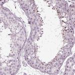 LRRIQ3 Antibody in Immunohistochemistry (IHC)