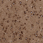 Adenylate Kinase 9 Antibody in Immunohistochemistry (Paraffin) (IHC (P))