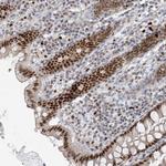 Adenylate Kinase 9 Antibody in Immunohistochemistry (Paraffin) (IHC (P))