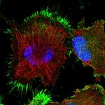 TASP1 Polyclonal Antibody