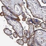 TASP1 Antibody in Immunohistochemistry (Paraffin) (IHC (P))