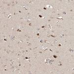 TASP1 Polyclonal Antibody