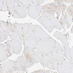 TASP1 Antibody in Immunohistochemistry (Paraffin) (IHC (P))