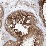 TASP1 Antibody in Immunohistochemistry (Paraffin) (IHC (P))